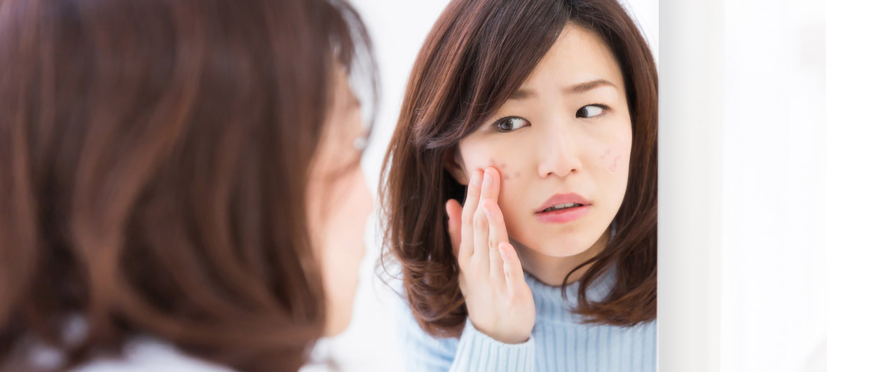 Menghilangka Bekas Jerawat Pada Kulit Sensitif