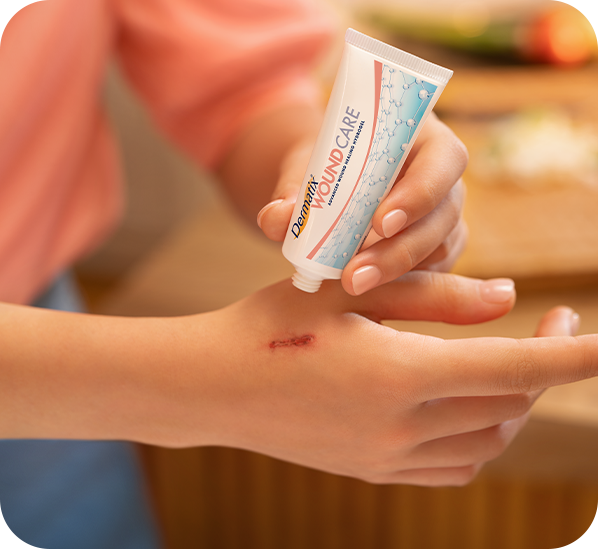 Meletakan Setitik Cream Salep